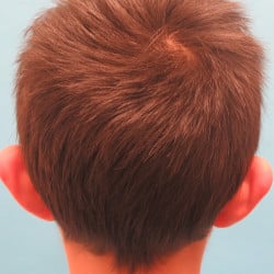 Before Image