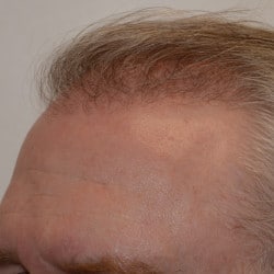 After Image