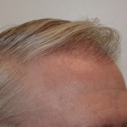 After Image
