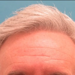 After Image