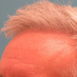 After Image