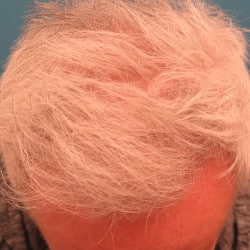 After Image