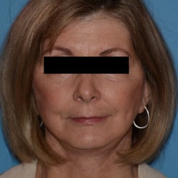 After Image