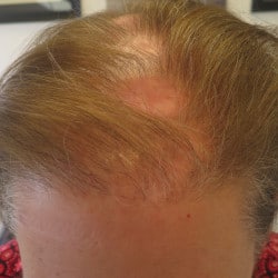 Before Image
