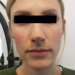 Before Image