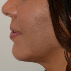 After Image