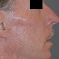 After Image