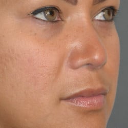 After Image