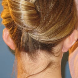Before Image