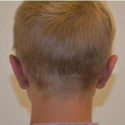 After Image