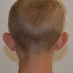 Before Image