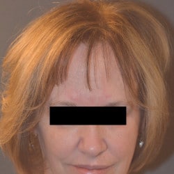 After Image