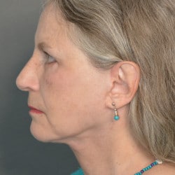 After Image