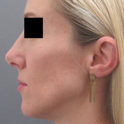 After Image