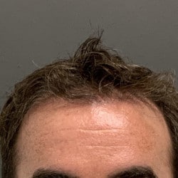 After Image