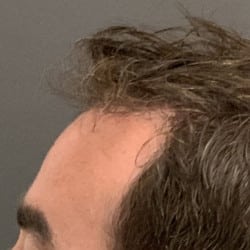 After Image