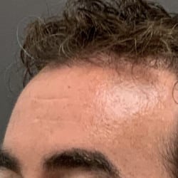 After Image