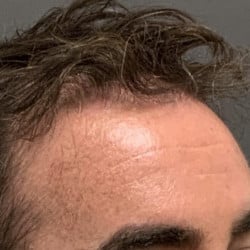After Image