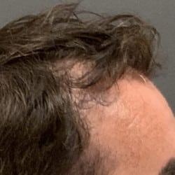 After Image
