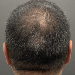 After Image