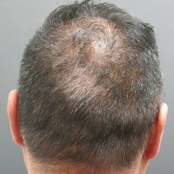 Before Image