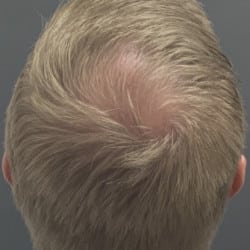 After Image