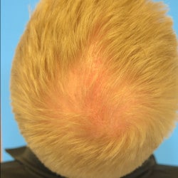 Before Image