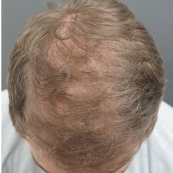 After Image