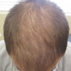 Before Image