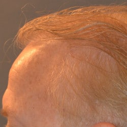 After Image