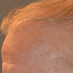After Image