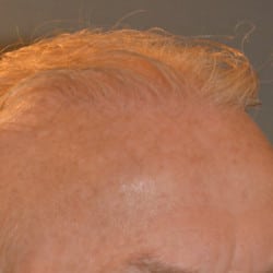 After Image