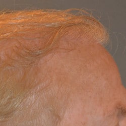 After Image