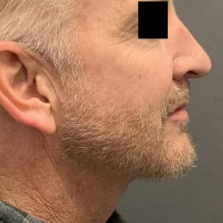 After Image