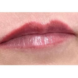 Lip Filler & Lip Blush