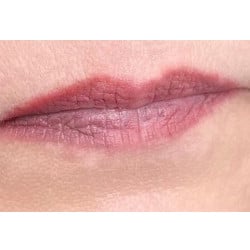 Lip Filler & Lip Blush