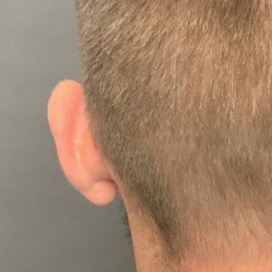 Before Image