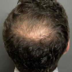 After Image