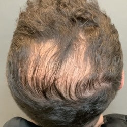 Before Image