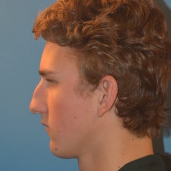 Before Image