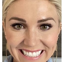 Botox