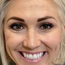 Botox