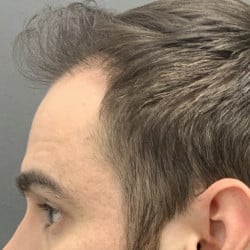 After Image