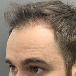 After Image