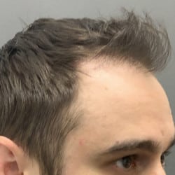 After Image