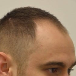 Before Image