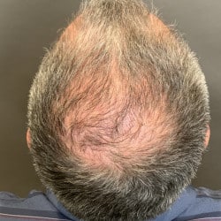 After Image