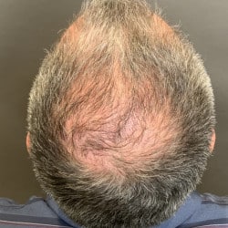 After Image