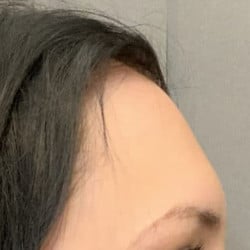 After Image