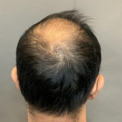 Before Image